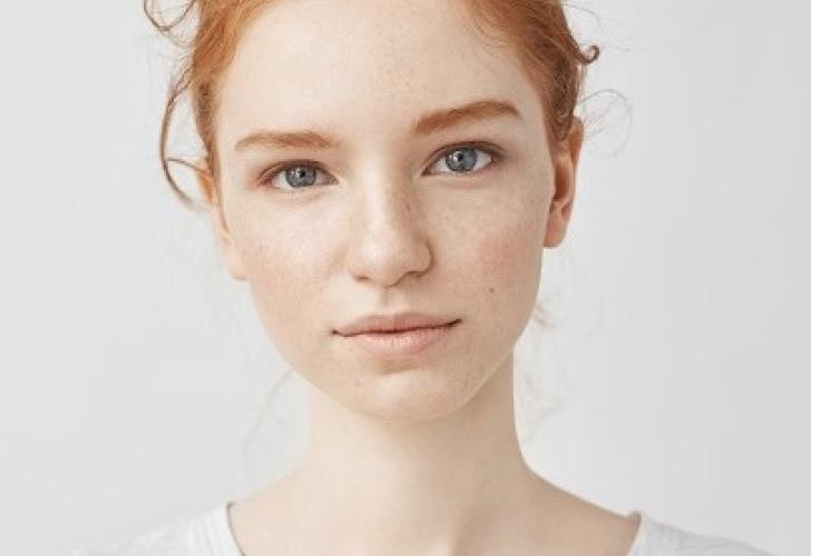 peau très claire - ph 1 et 2